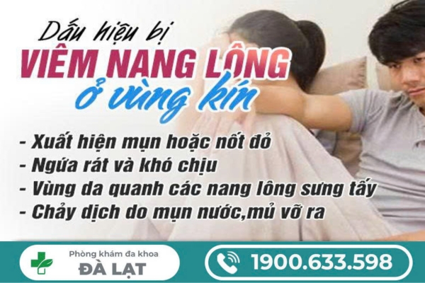 Hình ảnh minh họa